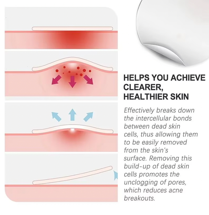 ClearSkin Pimple Patches diagram showing how hydrocolloid technology absorbs impurities and heals acne through three treatment stages