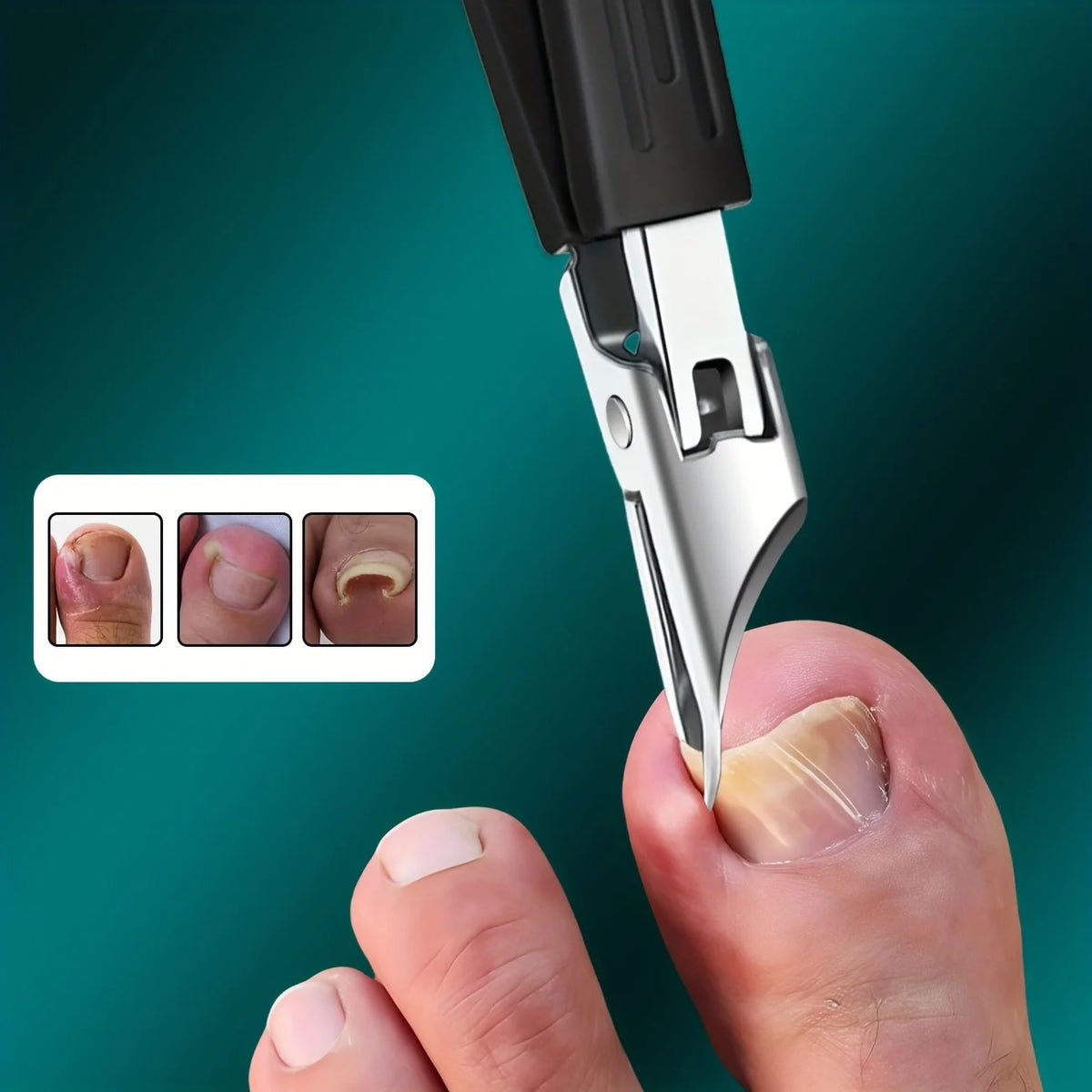 Angled Toenail Clippers with a black handle positioned beside a toenail, plus three nail-detail insets.