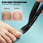Ingrown Toenail Clippers positioned beside a big toenail with a supplier nail-trimming comparison.
