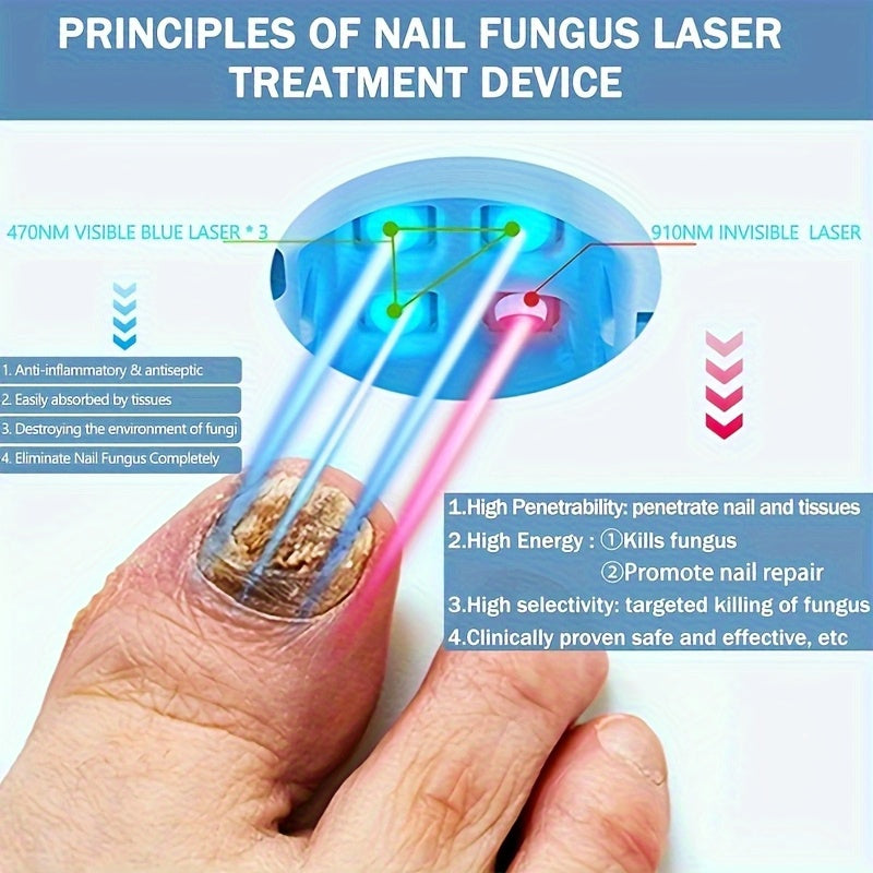 Nail Fungus Laser